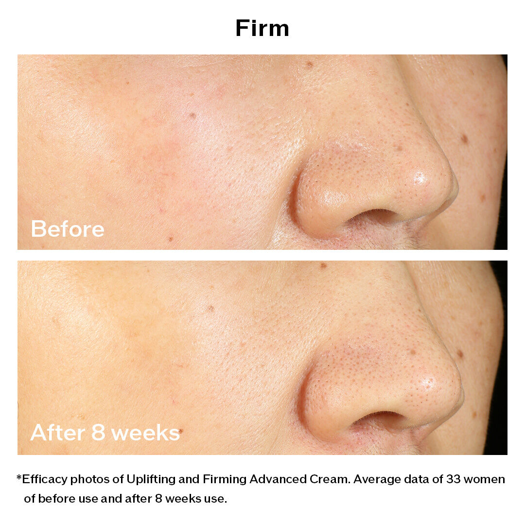 Uplifting and Firming Advanced Cream (Refill) - VITAL