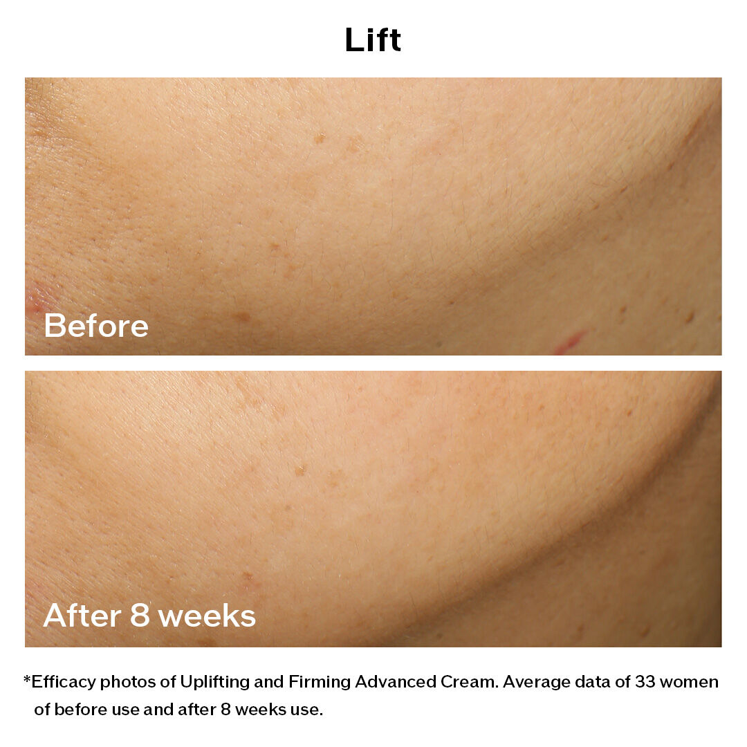 Uplifting and Firming Advanced Cream - VITAL PERFECTION