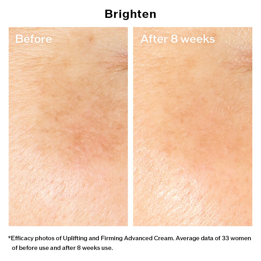 Uplifting and Firming Advanced Cream - VITAL PERFECTION